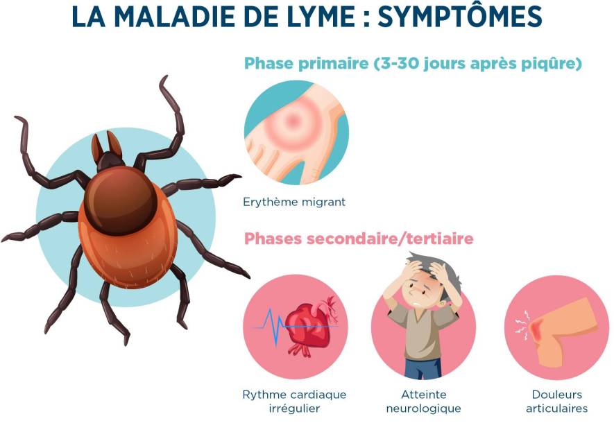 Peut-on guérir de la maladie de Lyme avec du CBD ?